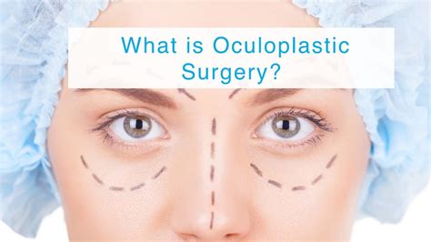 Gain Confidence with Oculoplastic Surgery: Explore Your Options with an Experienced Optometrist